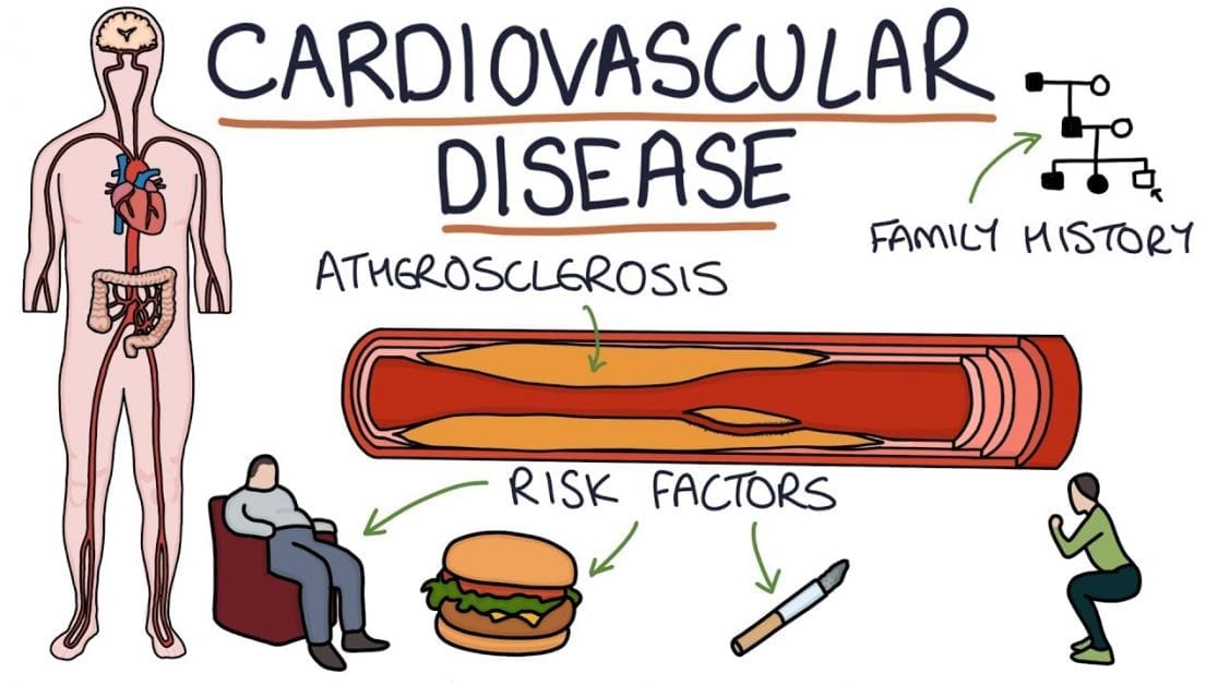 Cardiovascular