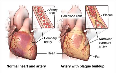 Cardiovascular