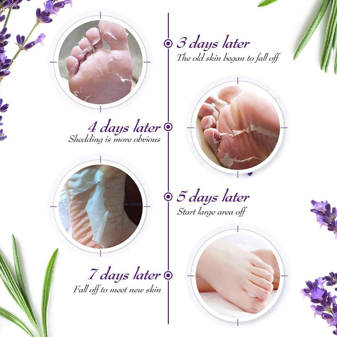 Foot Peel Mask Do Foot Peels Mask Work? Magazineup