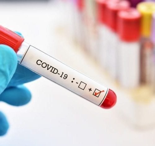 Novel Coronavirus (COVID-19)-Symptoms and Prevention