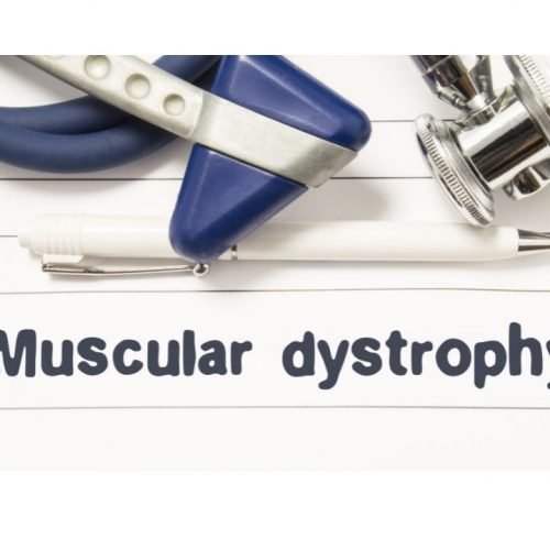 Muscular dystrophy-Signs and symptoms