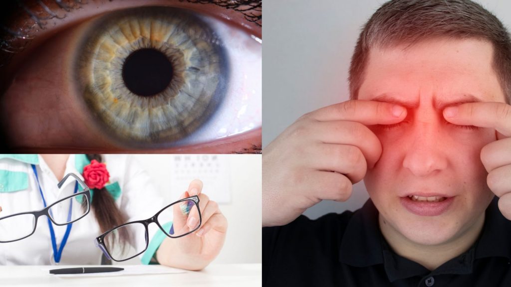 eyes