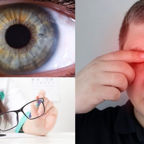Uveitis: Causes, symptoms, and treatment